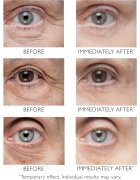 Peter Thomas Roth Instant FIRMx Eye krema za predel okoli oči za pomladitev kože 30 ml