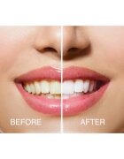 RIO USB teeth whitening set za beljenje zob