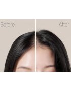 RYO Root:Gen Hair Loss Care Treatment krepilna nega proti izpadanju las za ženske 353 ml