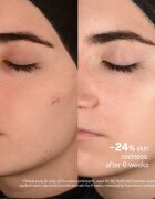 SKINSOO PurifyCell Exosome Light Cream lahka vlažilna krema z mat učinkom 120 ml