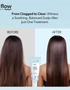 so!flow Cleansing Trichological Peeling piling za lasišče 100 ml