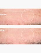 The Ordinary Hyaluronic Acid 2% + B5 vlažilni serum s ceramidi 30 ml