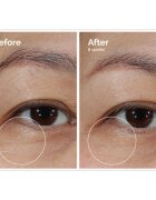 The Ordinary Lacto-PDRN* 4% + B9 Eye Cream gladilna krema za predel okoli oči proti gubam okoli oči 15 ml