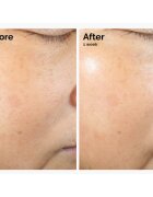 The Ordinary Rice Lipids + Ectoin Microemulsion lahka vlažilna emulzija za pomiritev kože 60 ml