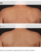 The Ordinary Salicylic Acid 0.5% Body Serum izpopolnjevalni serum za telo s salicilno kislino 240 ml