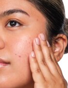 The Ordinary Salicylic Acid 2% Solution serum s salicilno kislino 30 ml
