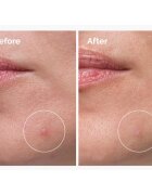 The Ordinary Sulfur 10% Powder-to-Cream Concentrate lokalna nega proti aknam 5 g
