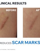 Uriage Bariederm Cica+ Repairing Cream krepilna krema z vsebnostjo bakra in cinka 100 ml