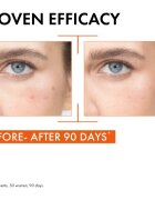 Vichy Liftactiv Supreme posvetlitveni serum za obraz z vitaminom C 20 ml