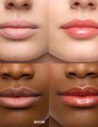 WONDERSKIN Lip Rehab Serum Oil olje za ustnice odtenek 3.57 ml