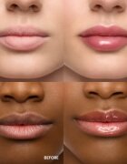 WONDERSKIN Lip Rehab Serum Oil olje za ustnice odtenek Lover 3.57 ml