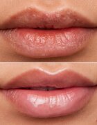 WONDERSKIN Lip Rehab Therapy Oil olje za ustnice z vlažilnim učinkom odtenek Clear 357 ml