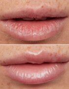WONDERSKIN Lip Rehab Therapy Oil olje za ustnice z vlažilnim učinkom odtenek Clear 357 ml