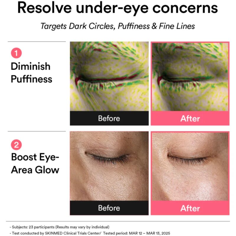 Abib PDRN Retinal Eye Patch Glow Jelly blazinice za pod oči proti gubam zabuhlosti in temnim kolobarjem 60 kos