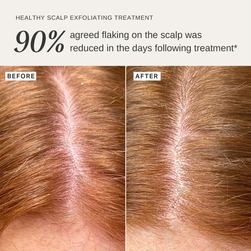 Alpha-H Healthy Scalp eksfoliacijska raztopina za glavo 100 ml