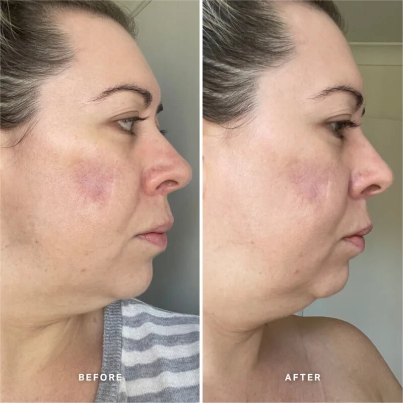 Alpha-H Vitamin A serum z vitaminom A 25 ml