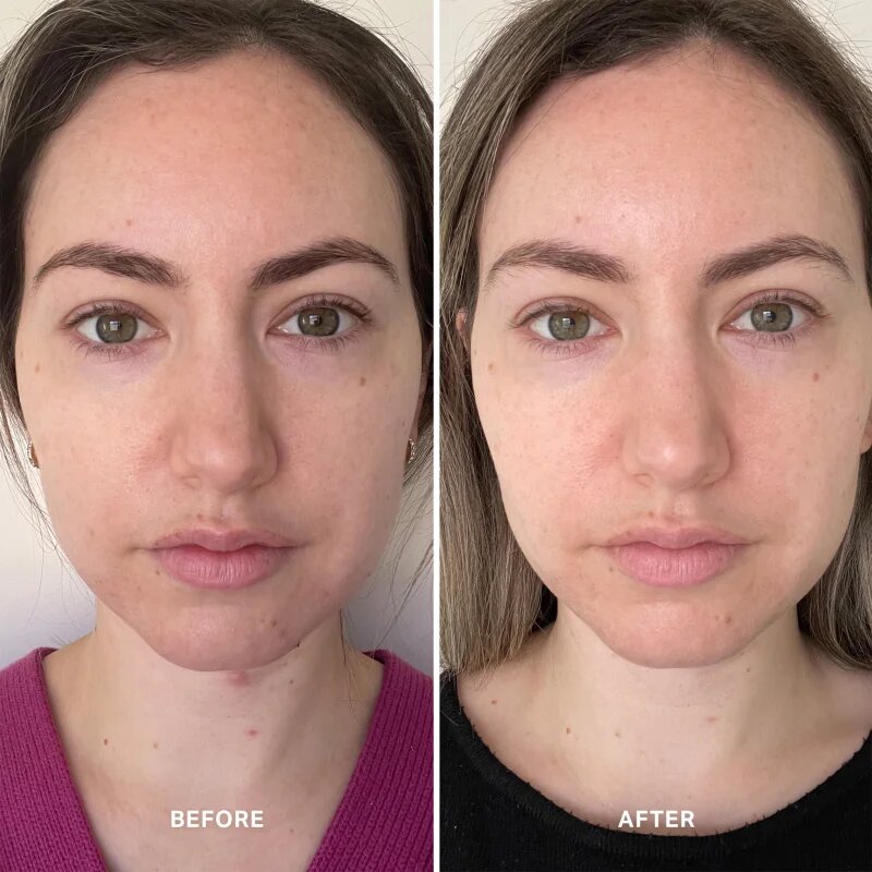 Alpha-H Vitamin B serum za krepitev kožne pregrade 25 ml