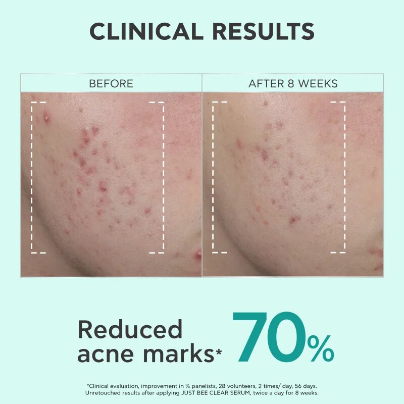 Apivita Just Bee Clear Serum serum za mastno in problematično kožo 30 ml
