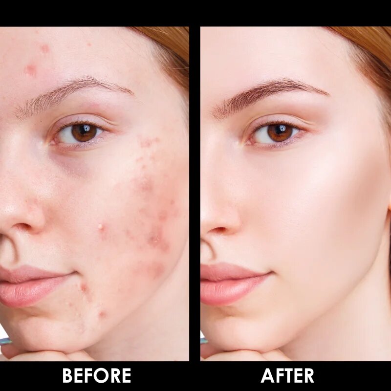 Arval Puractiva Bio-Balancing Cream čistilna krema z regeneracijskim učinkom 50 ml