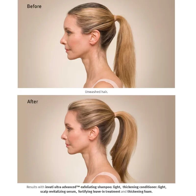 Aveda Invati Ultra Advanced™ Revitalizing Scalp Serum obnovitveni serum za lase in lasišče 30 ml