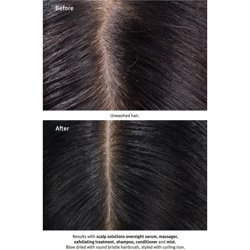 Aveda Scalp Solutions Replenishing Conditioner nežen balzam za prehrano in hidracijo 200 ml
