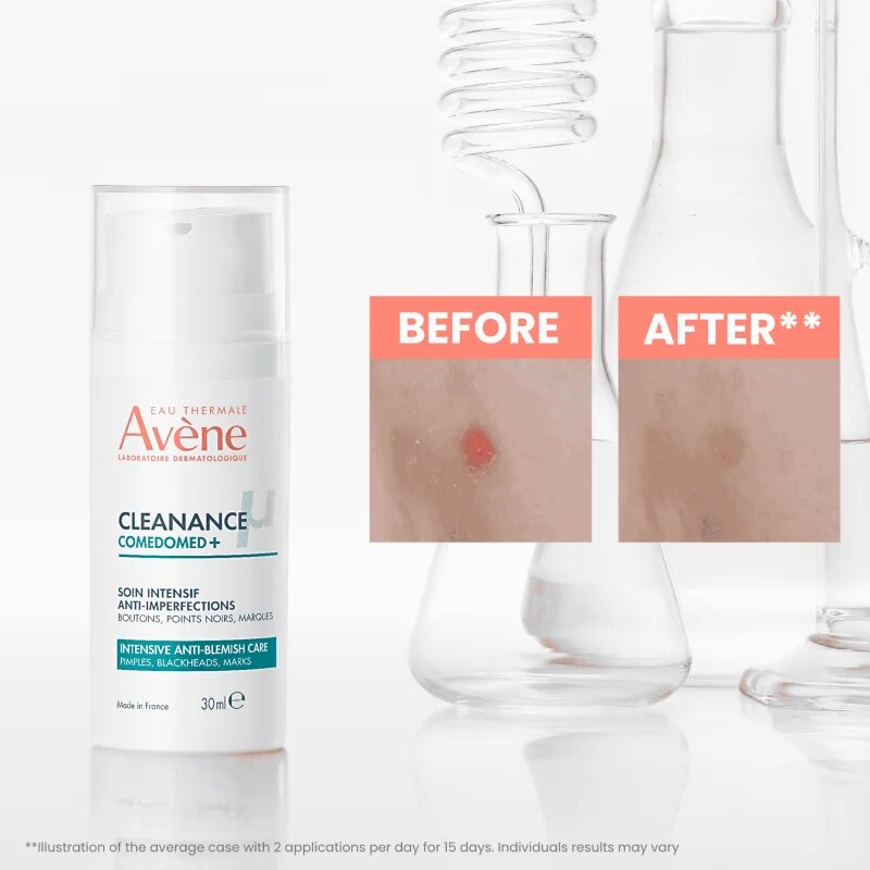 Avène Cleanance Comedomed+ intenzivna nega proti nepravilnostim na aknasti koži 30 ml
