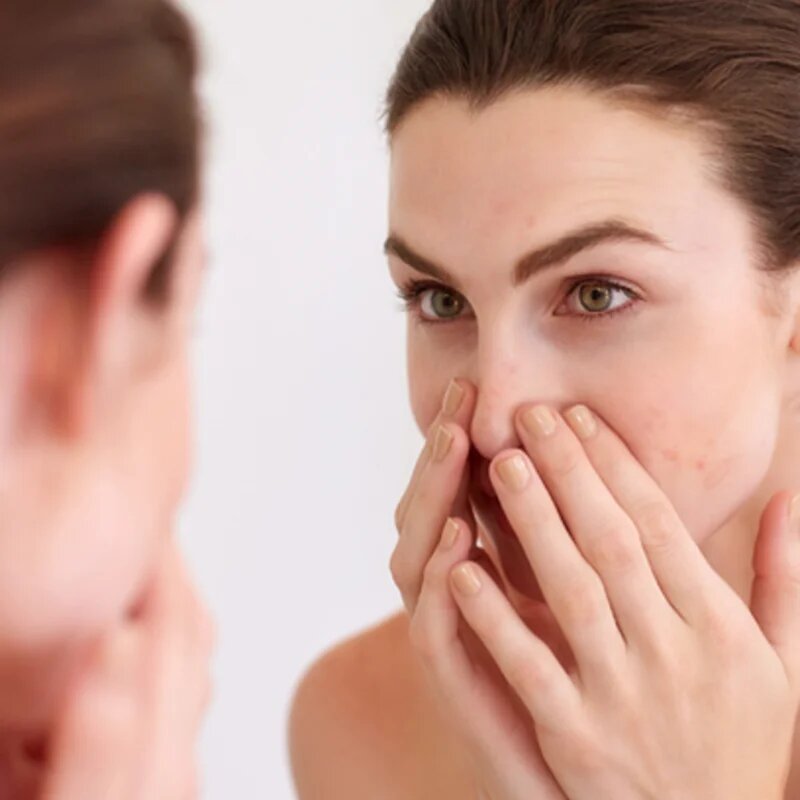 Avène Cleanance micelarna voda za mastno in mešano kožo 400 ml