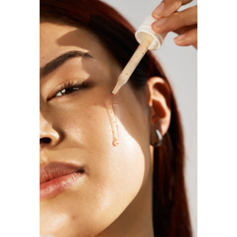 Carbon Theory Succinic Acid & Niacinamide obnovitveni serum za obraz za problematično kožo 30 ml