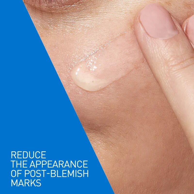 CeraVe Control Cleanser & Retinol Serum Duo kompleksna nega proti nepravilnostim na aknasti koži