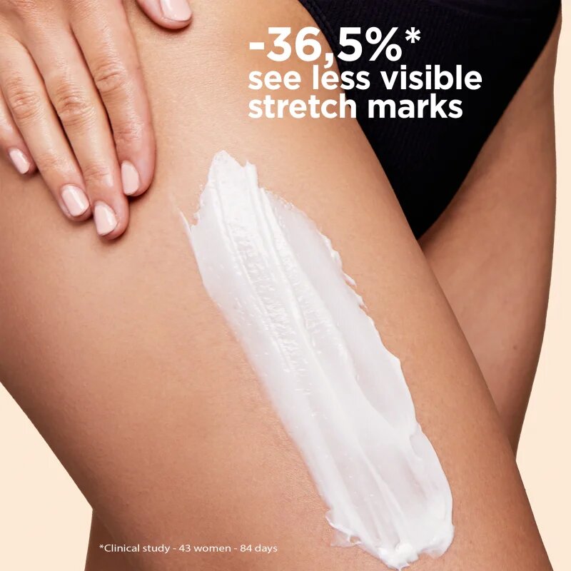Clarins Body Partner Stretch Mark Expert pomirjajoča krema za telo za preprečevanje in zmanjševanje strij 175 ml