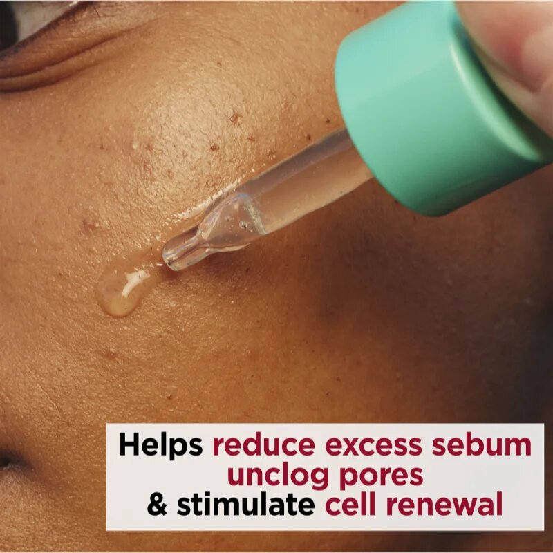 Clarins My Pure-Reset Resurfacing Blemish Serum obnovitveni serum za mastno k aknam nagnjeno kožo 30 ml