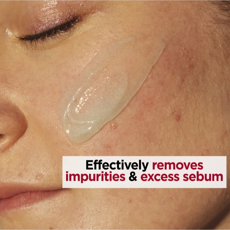 Clarins My Re-Move Purifying Cleansing Gel čistilni gel za obraz za kožo z nepravilnostmi 125 ml