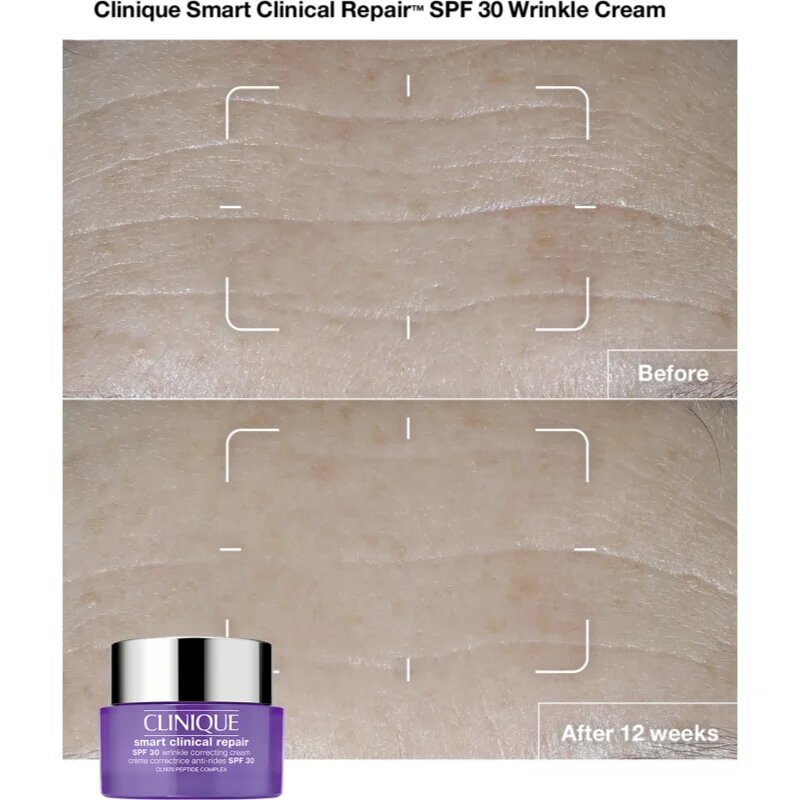 Clinique Smart Clinical™ Repair Wrinkle Correcting Cream SPF 30 krema proti gubam SPF 30 75 ml