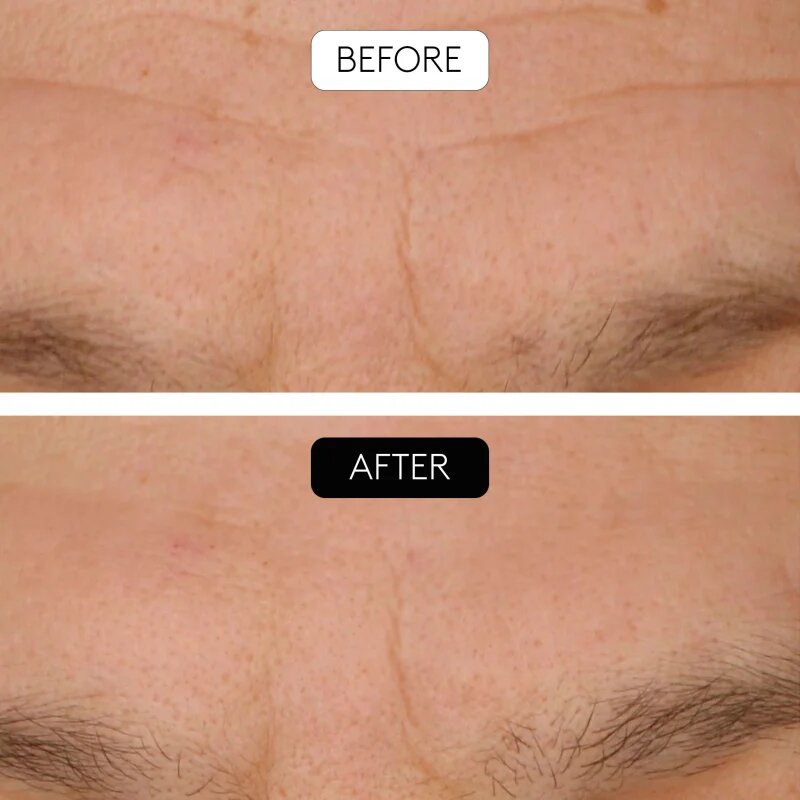 Cocunat Clinical Beauty Filler set proti staranju kože