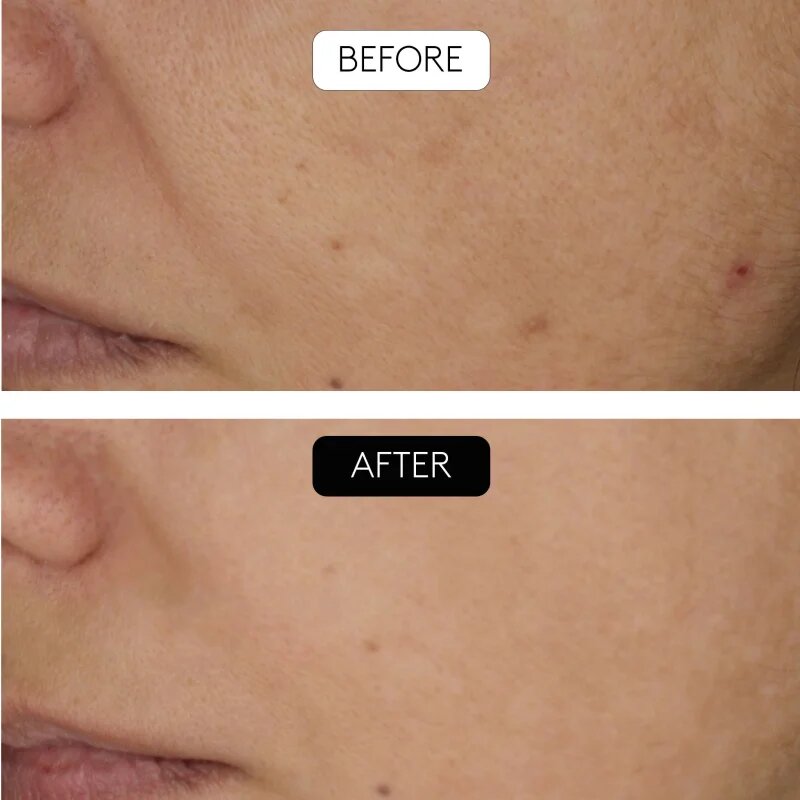 Cocunat Clinical Beauty Filler set proti staranju kože
