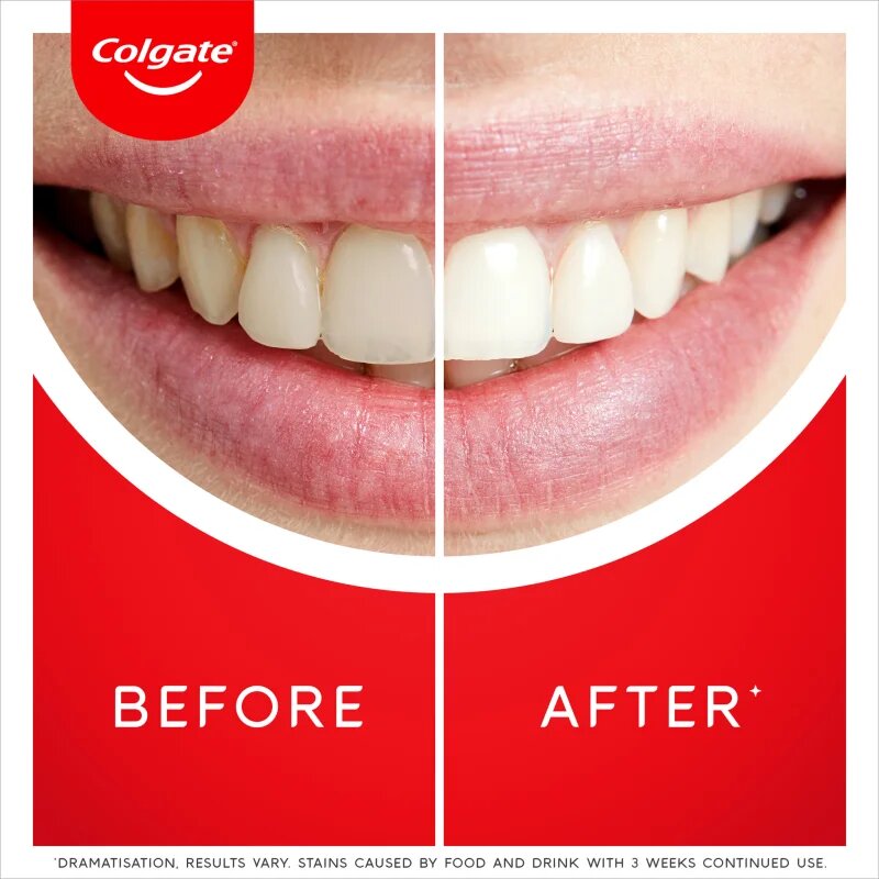 Colgate Max White Ultra Freshness Pearls belilna zobna pasta 50 ml