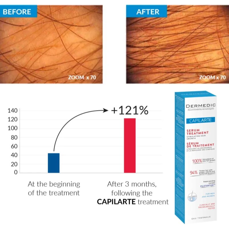 Dermedic Capilarte serum za spodbujanje rasti las z regeneracijskim učinkom 150 ml