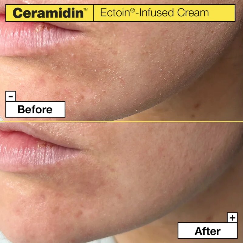 Dr. Jart+ Ceramidin™ Ectoin-Infused Cream vlažilna krema za obraz s ceramidi 50 ml