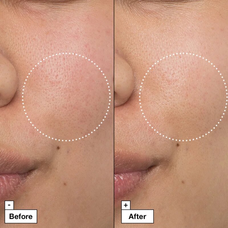 Dr. Jart+ Cicapair™ Intensive Soothing Repair Cream intenzivna krema za zmanjšanje rdečice 50 ml