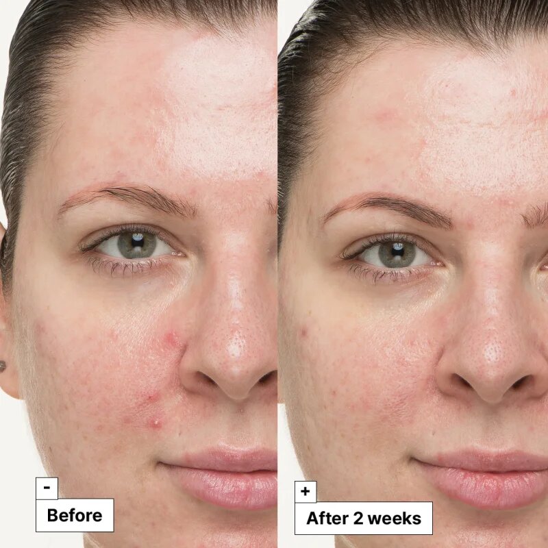 Dr. Jart+ Cicapair™ So Soothing Treatment lokalna nega za zmanšanje rdečice 30 ml