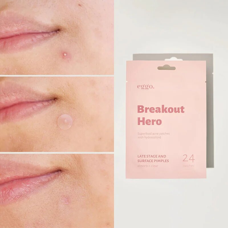 Eggo Breakout Hero obliži za problematično kožo 24 kos