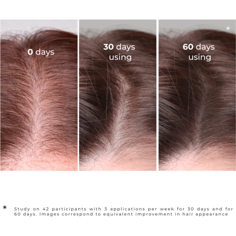 Elfa Pharm Intensive Cosmetic Intensive Hair Therapy Burdock Serum serum proti izpadanju las z rastnim aktivatorjem 100 ml