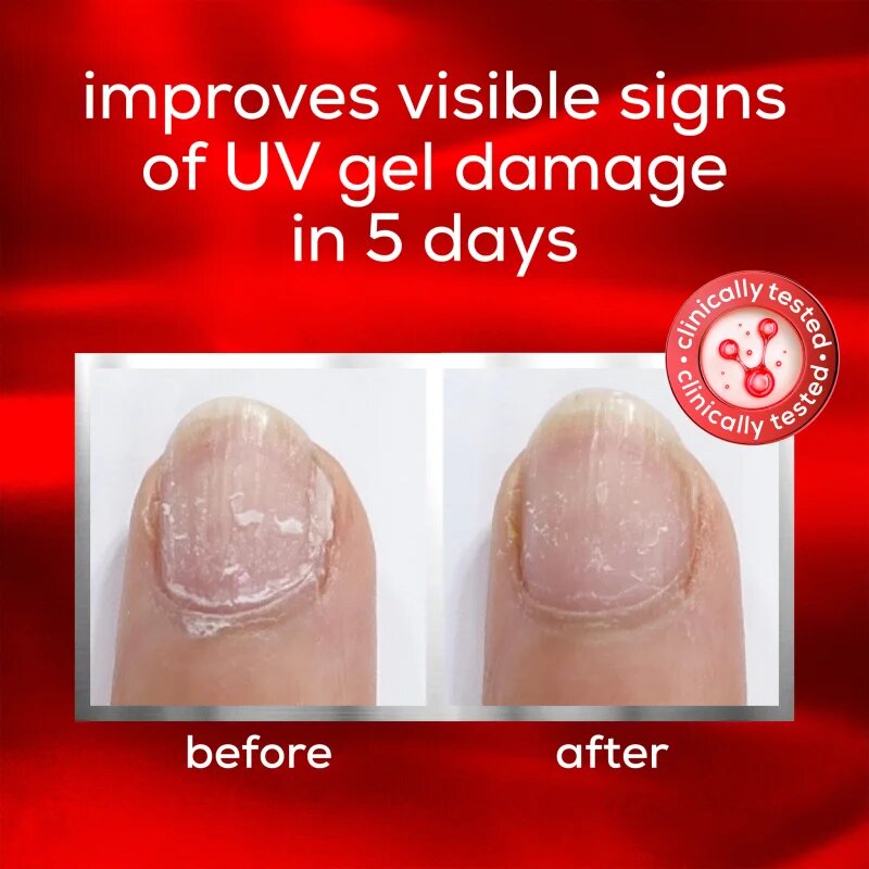 Essie to the rescue negovalni lak za nohte za poškodovane nohte 13.5 ml