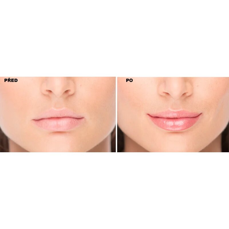 FacEvolution LipPlus Booster nega za povečanje volumna ustnic odtenek Transparent 5 ml