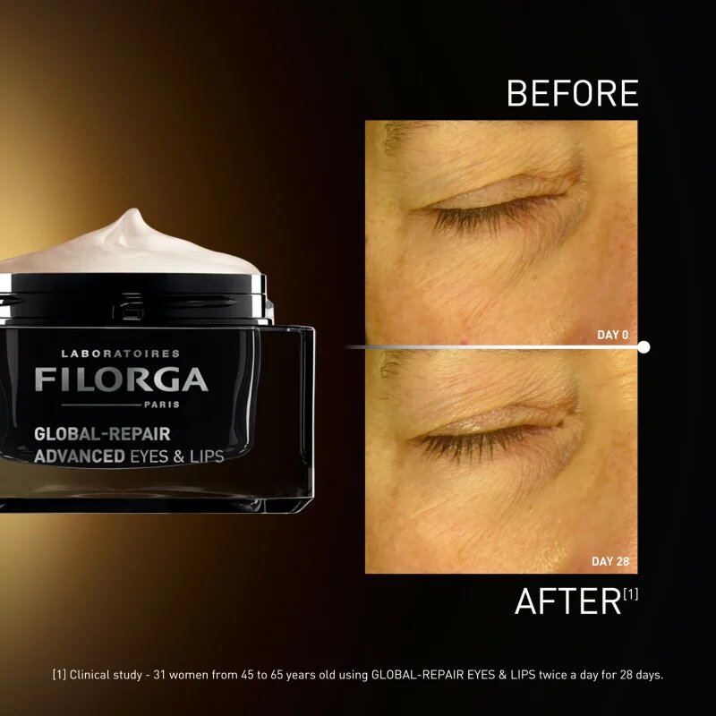 FILORGA GLOBAL-REPAIR ADVANCED EYES & LIPS krema proti gubam za konture oči in ustnic 15 ml
