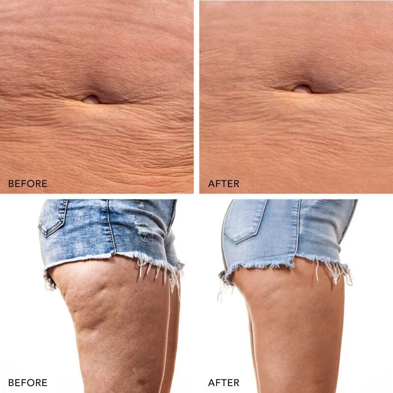 FOREO BEAR™ 2 body mikrotokovna naprava za čvrstejši obraz za telo Evergreen 1 kos