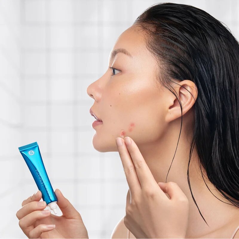 FOREO ESPADA™ BHA+PHA Blemish Solution lokalni gel za akne 15 ml