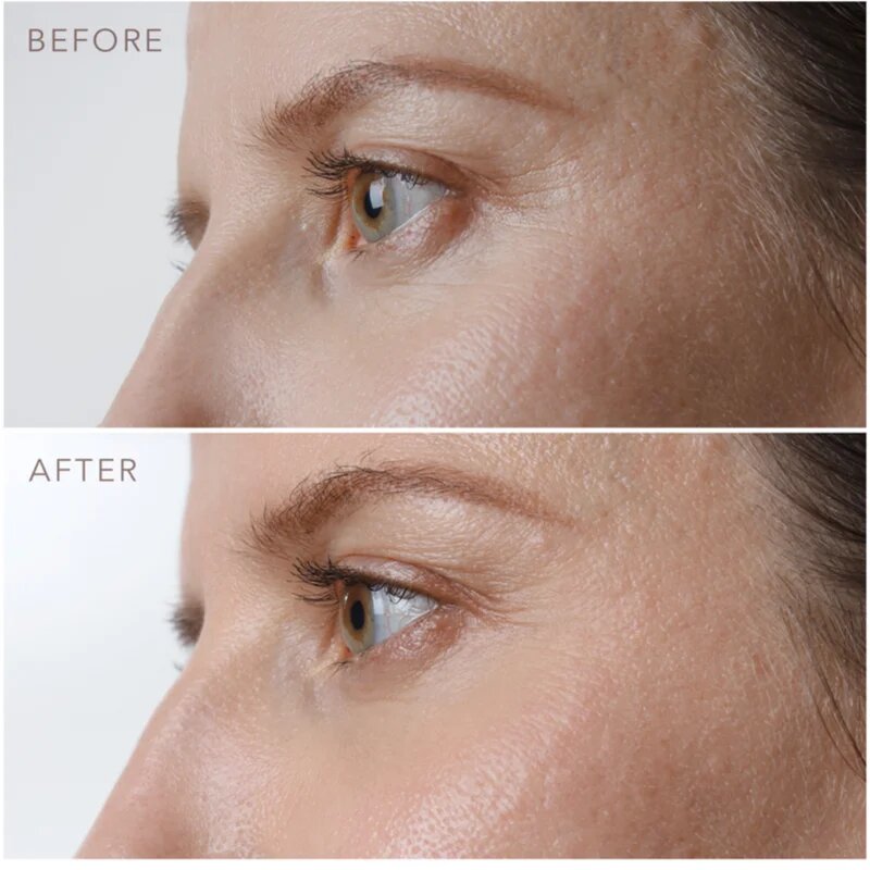 FOREO IRIS™ Firming Eye Serum pomlajevalni serum za predel okoli oči 15 ml