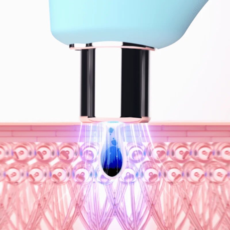 FOREO KIWI™ vakuumski pripomoček za odstranjevanje ogrcev z modro svetlobo LED 1 kos