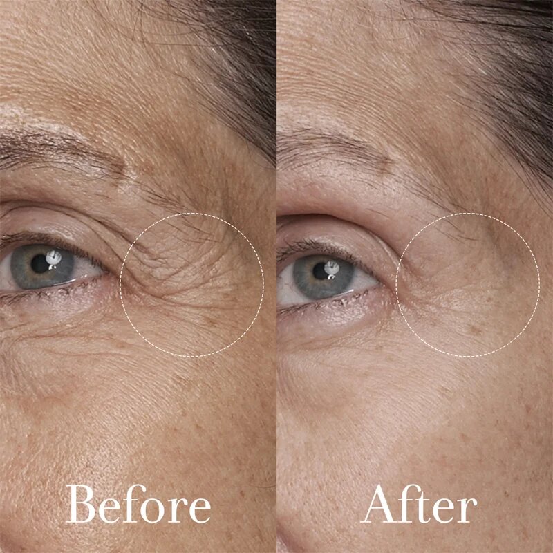 fresh Black Tea Age Renewal Eye Concentrate pomlajevalna krema za predel okoli oči 15 ml